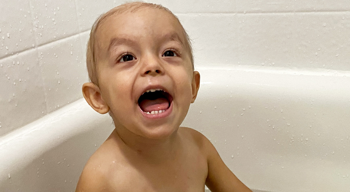 3400 - Myoepithelial Carcinoma Biology & EWSR1 Orphan Cancers Drug Discovery Program